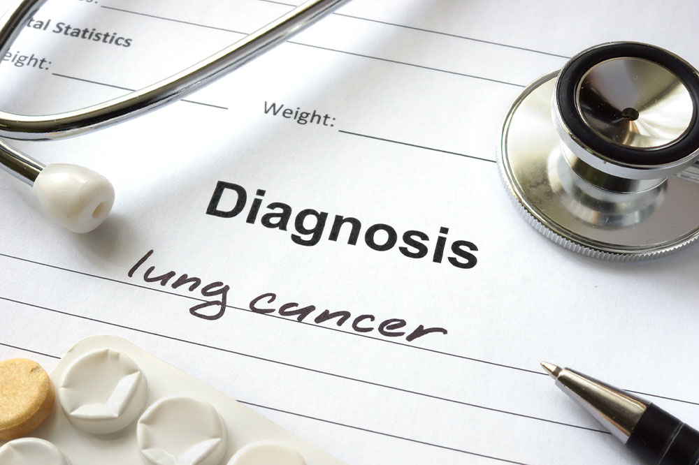 Lung Cancer – Types, Causes, and Symptoms