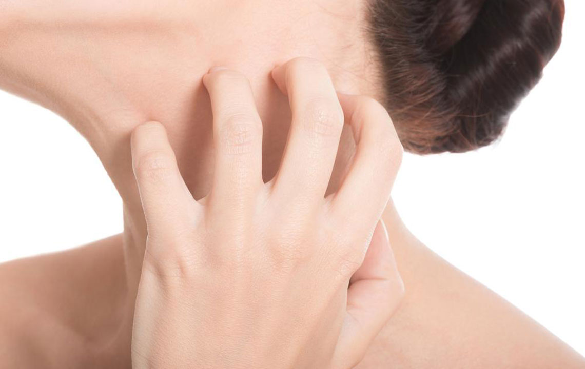6 common types of eczema disorders you should know about